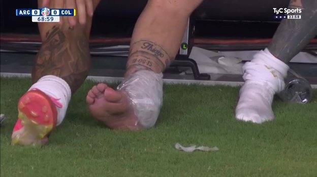 Лед, приложенный к лодыжке Лионеля Месси.