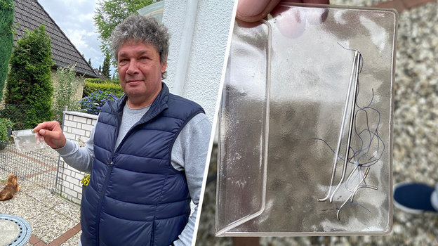 Юрий Савичев показывает спицу, которая была в его стопе за два месяца до Олимпиады-1988.