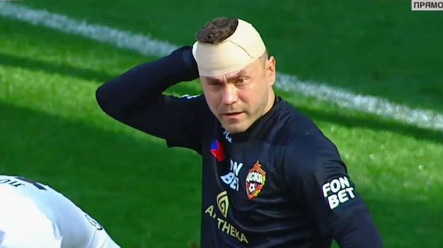 Игорь Акинфеев.