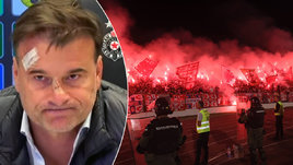 Что натворили фанаты «Партизана»?! Рассекли лицо своему тренеру и разгромили раздевалку