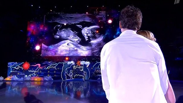 Снимок УЗИ, появившийся на экране во время выступления Александры Трусовой и Макара Игнатова на турнире шоу-программ «Русский вызов».