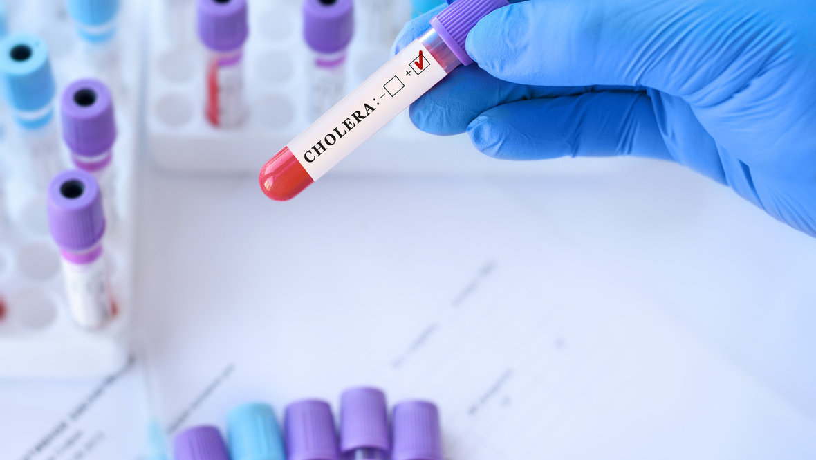 Пробирка с вирусом холеры