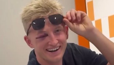 Литвинов избежал сотрясения мозга после столкновения с Бабичем в матче с «Крыльями»