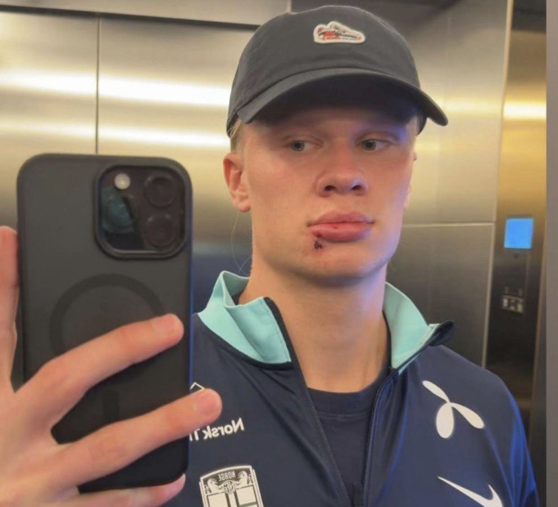 Эрлин Холанн.