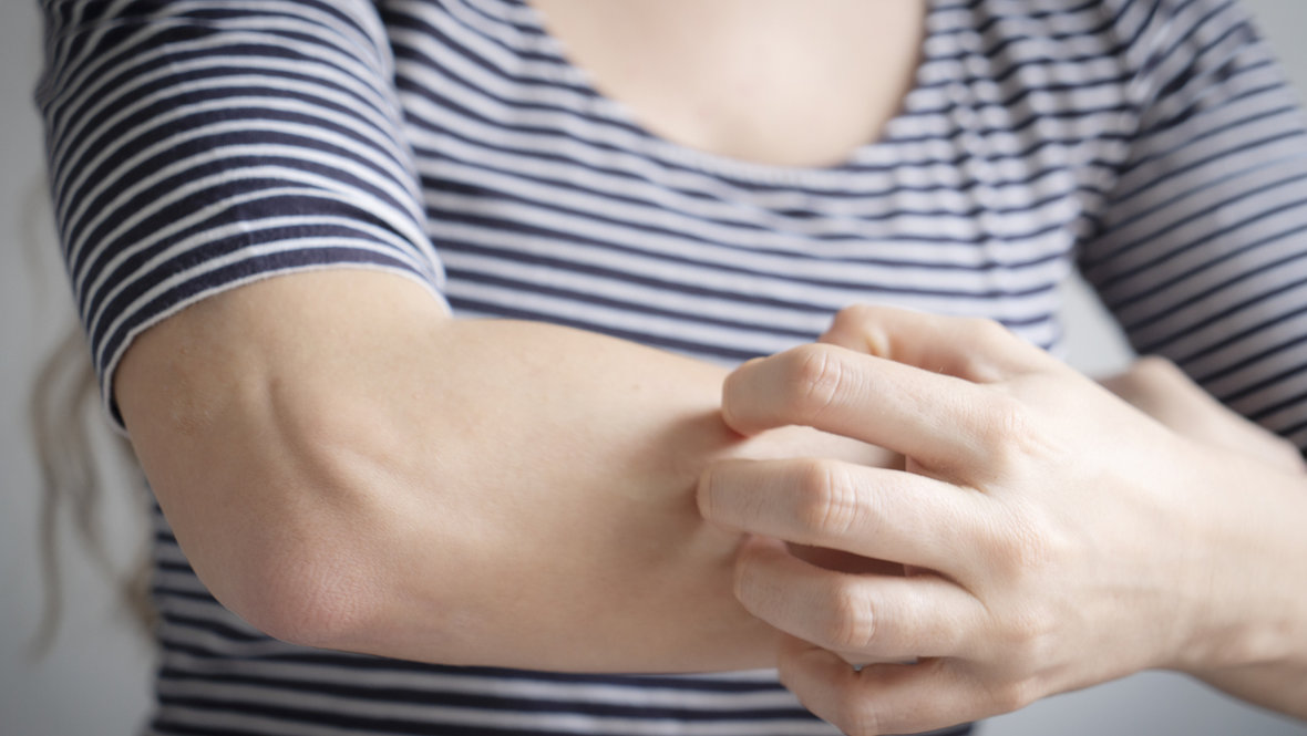 Зуд от паразитов