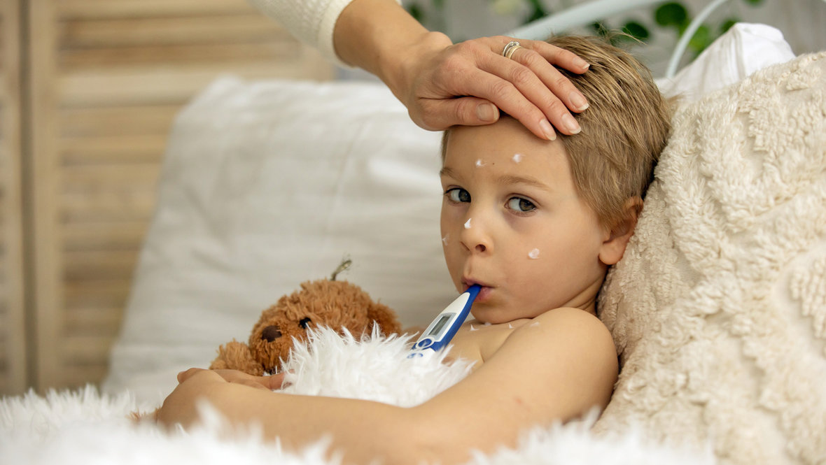 Мальчик болеет ветрянкой