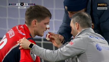 «Локомотив» — ЦСКА: Дивеев получил рассечение носа