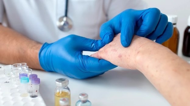 На приеме у врача с ветрянкой