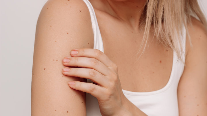 Девушка с родинками