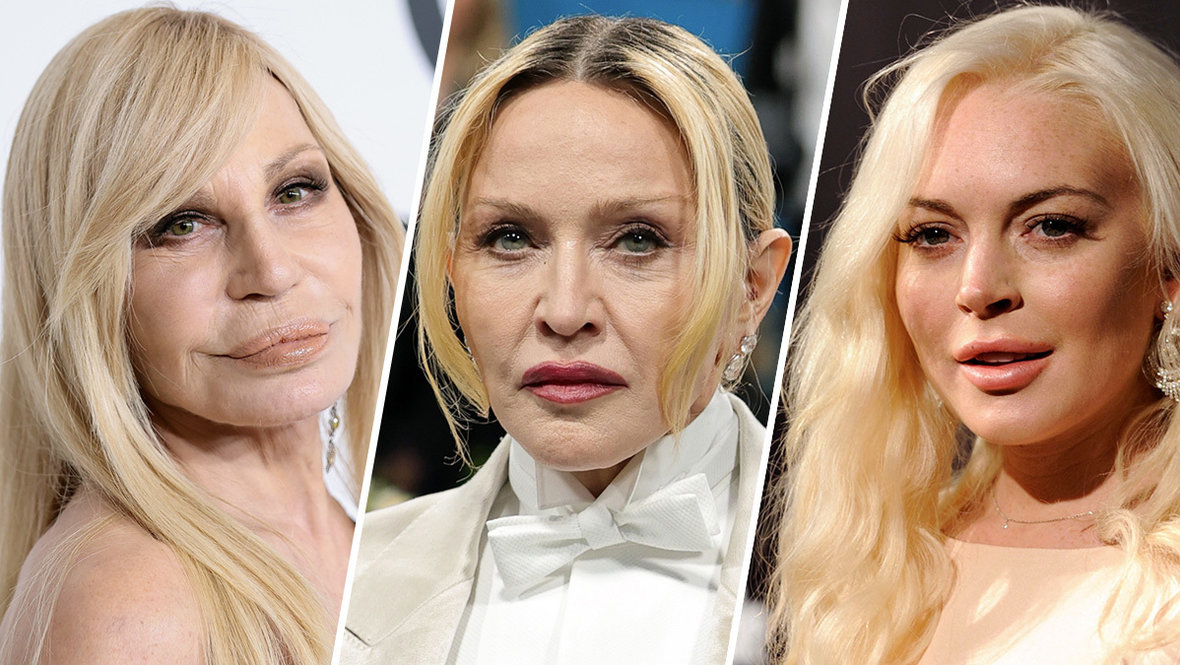 11 зарубежных звезд, которые стали жертвами неудачной пластики