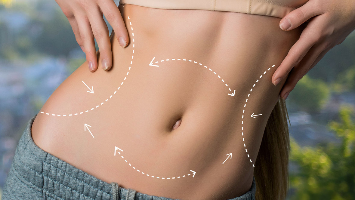 Хирург объяснил, какие риски возможны после проведения липосакции