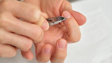 Врач ответила, что будет, если отрывать заусенцы