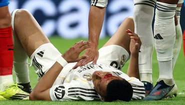 Арбелоа: «Фол на Мбаппе — это явный пенальти. И здесь, и на Луне»