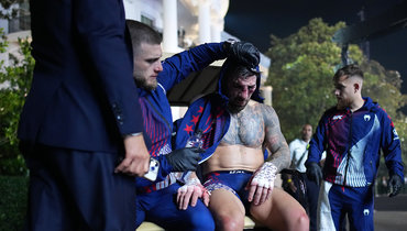 Глава UFC Дана Уайт: «Топурия в больнице. Возможно, у него перелом глазницы»